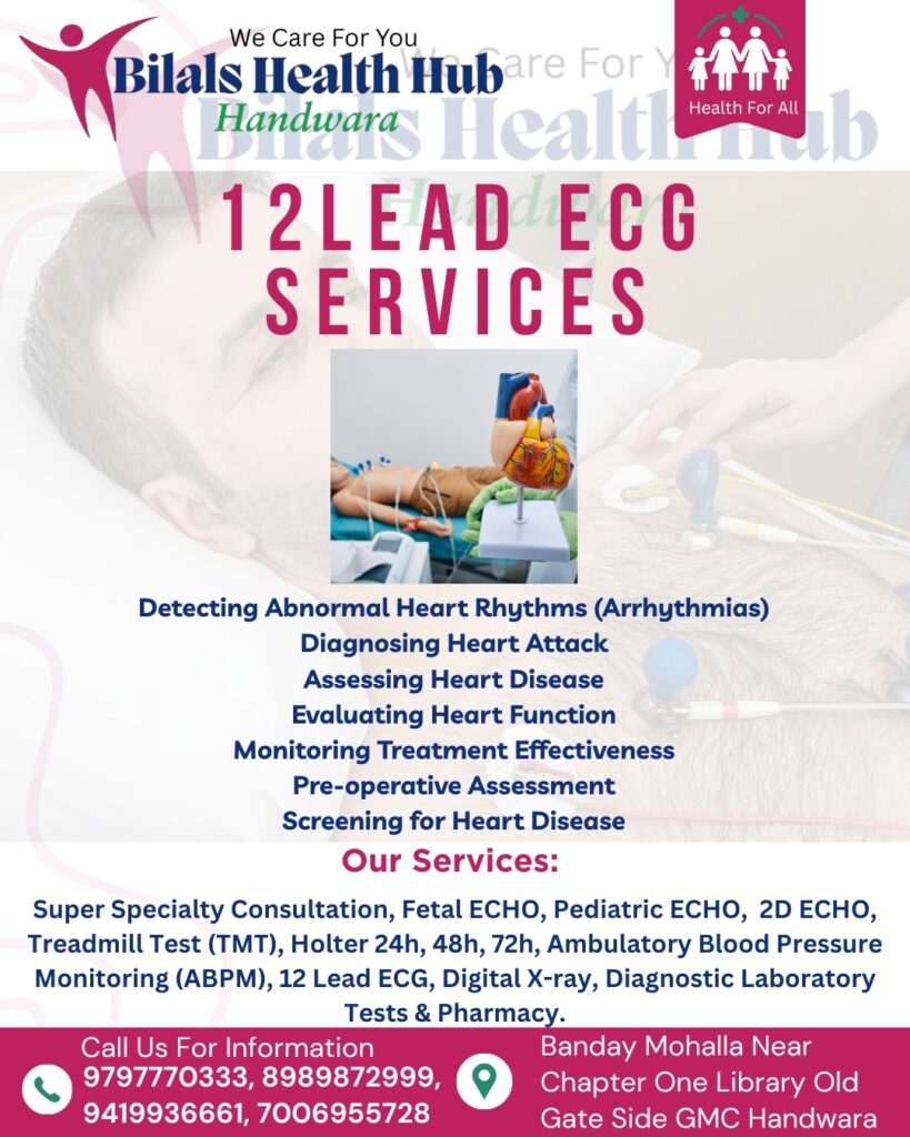 ecg